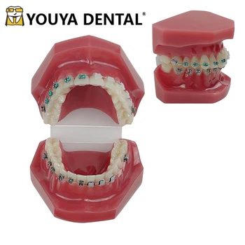 Ортодонтическая модель Модель зуба для студента-стоматолога, обучающегося на практике, Обучающего Инструмент общения врача и пациента